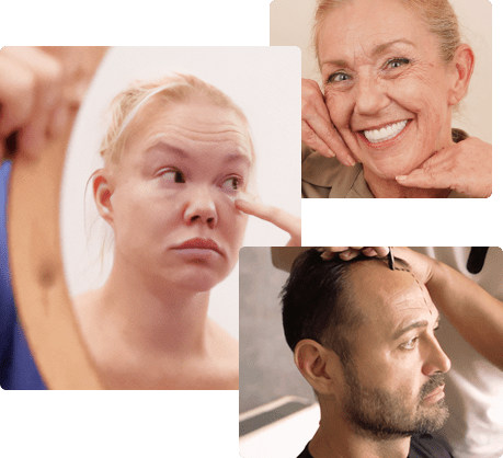 Collage of cosmetic procedure patients including eye, facial, and hair restoration cases