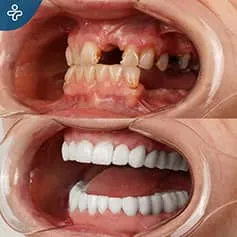 Before After Dentistry