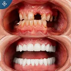 Before After Dentistry