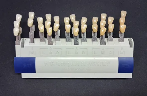 Faccette Dentali