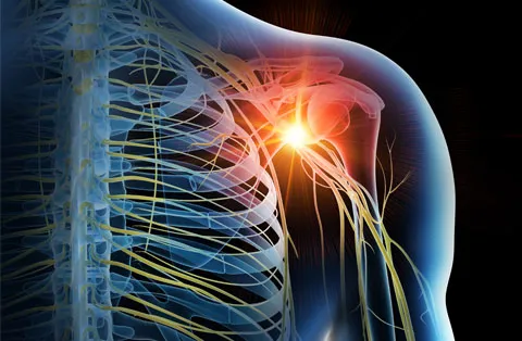 Neurólisis para el dolor crónico: lo que ofrece este procedimiento